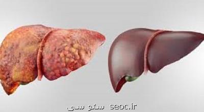 پژوهشگر ایرانی ژن موثر در بیماری کبد چرب را شناسایی کرد