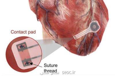 تولید نخستین ضربان ساز مصنوعی قلب كه در بدن حل می شود