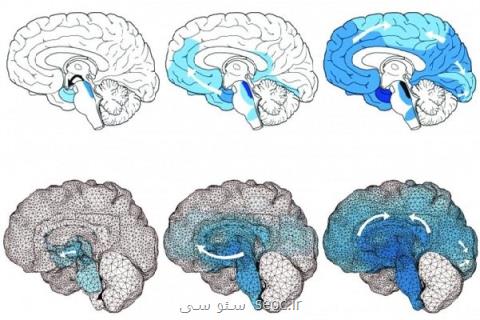 شبیه سازی مبتلا شدن به آلزایمر با مدل كامپیوتری